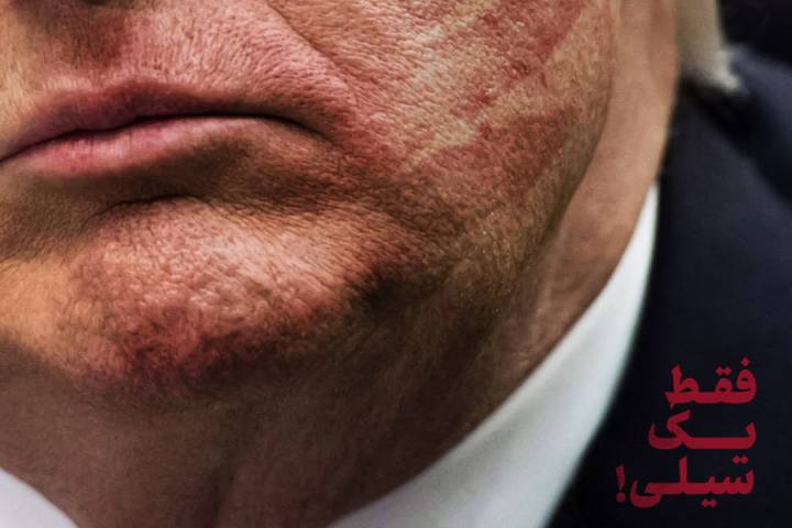 فقط یک سیلی