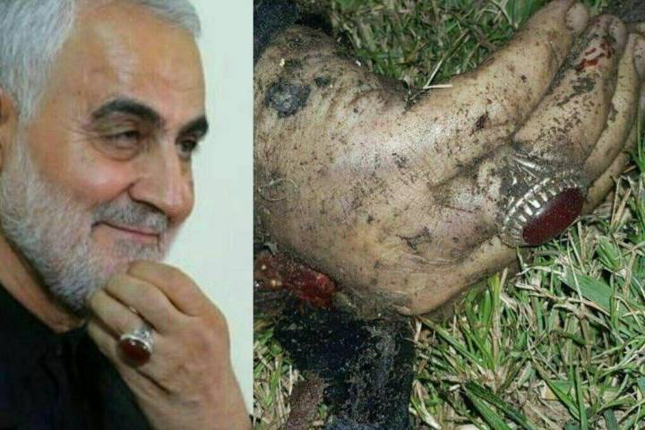  انگشت و انگشتر